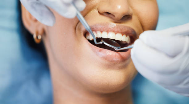 Best Emergency Dental Services for Seniors in Hidden Valley, IN
